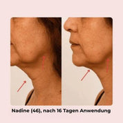 V-Line Face Lifting Mask