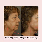 V-Line Face Lifting Mask